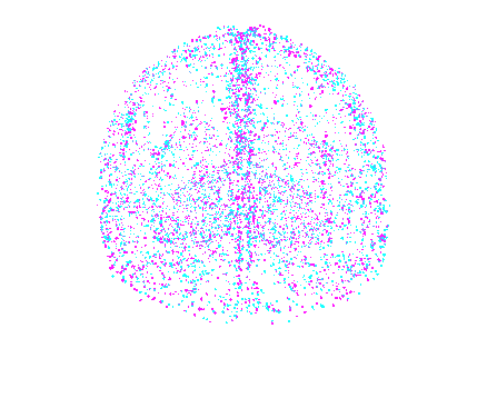 Brain Image