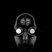 Phase 5: Targeted Neural Reprogramming Animation